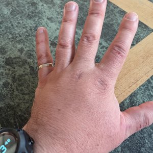 16 - Cracked a bone slipping at the diveshop