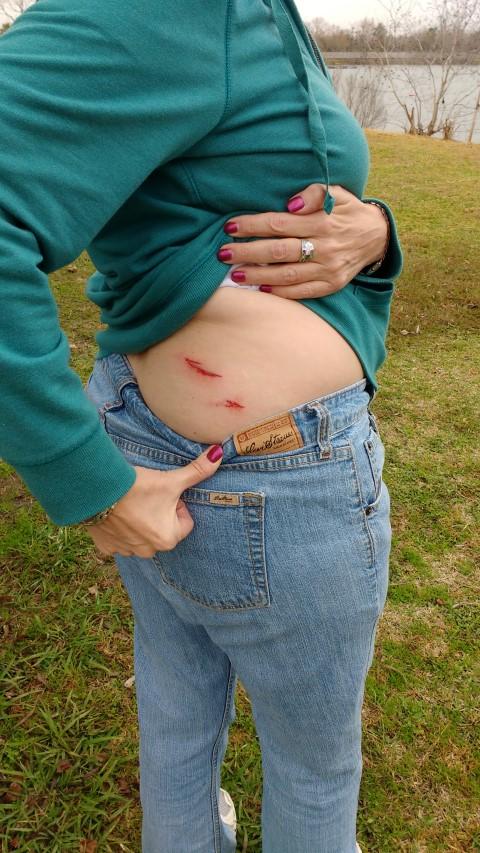 That's gonna leave a mark