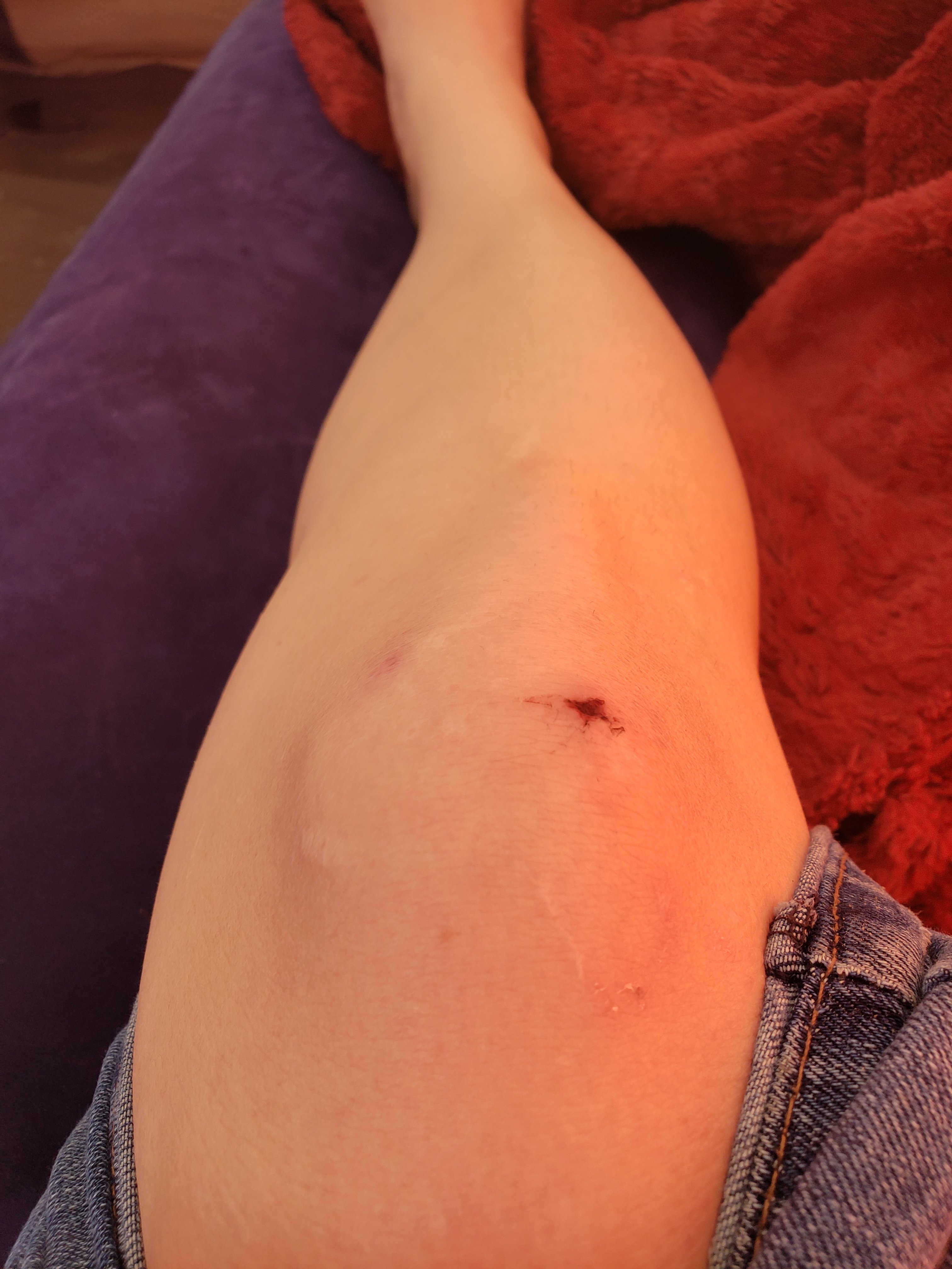 The Comal Claims CHUM